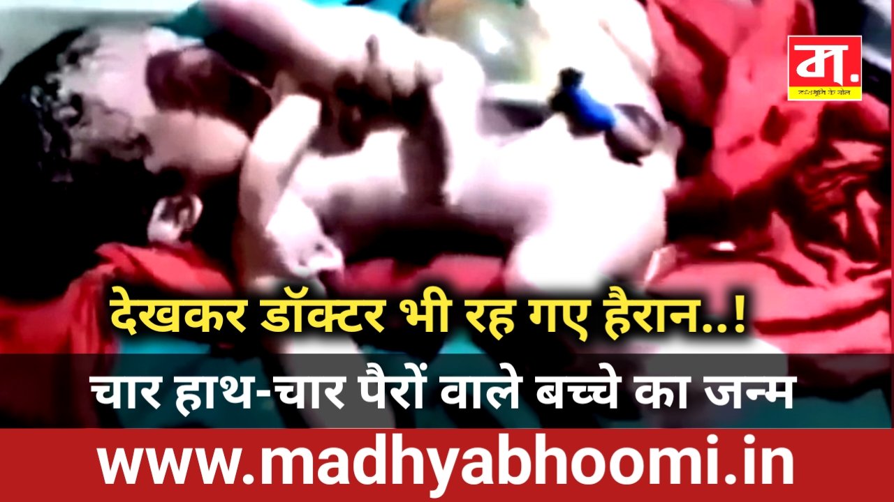 चार हाथ-चार पैरों वाले बच्चे का जन्म, देखकर डॉक्टर भी रह गए हैरान : एयर एंबुलेंस से जबलपुर रेफर